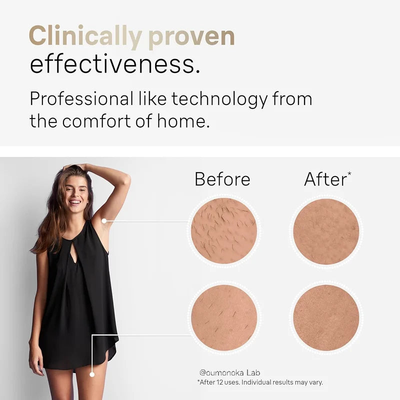 Dispositivo de depilación IPL Glow, máquina de depilación permanente con flashes para uso doméstico en mujeres y hombres.