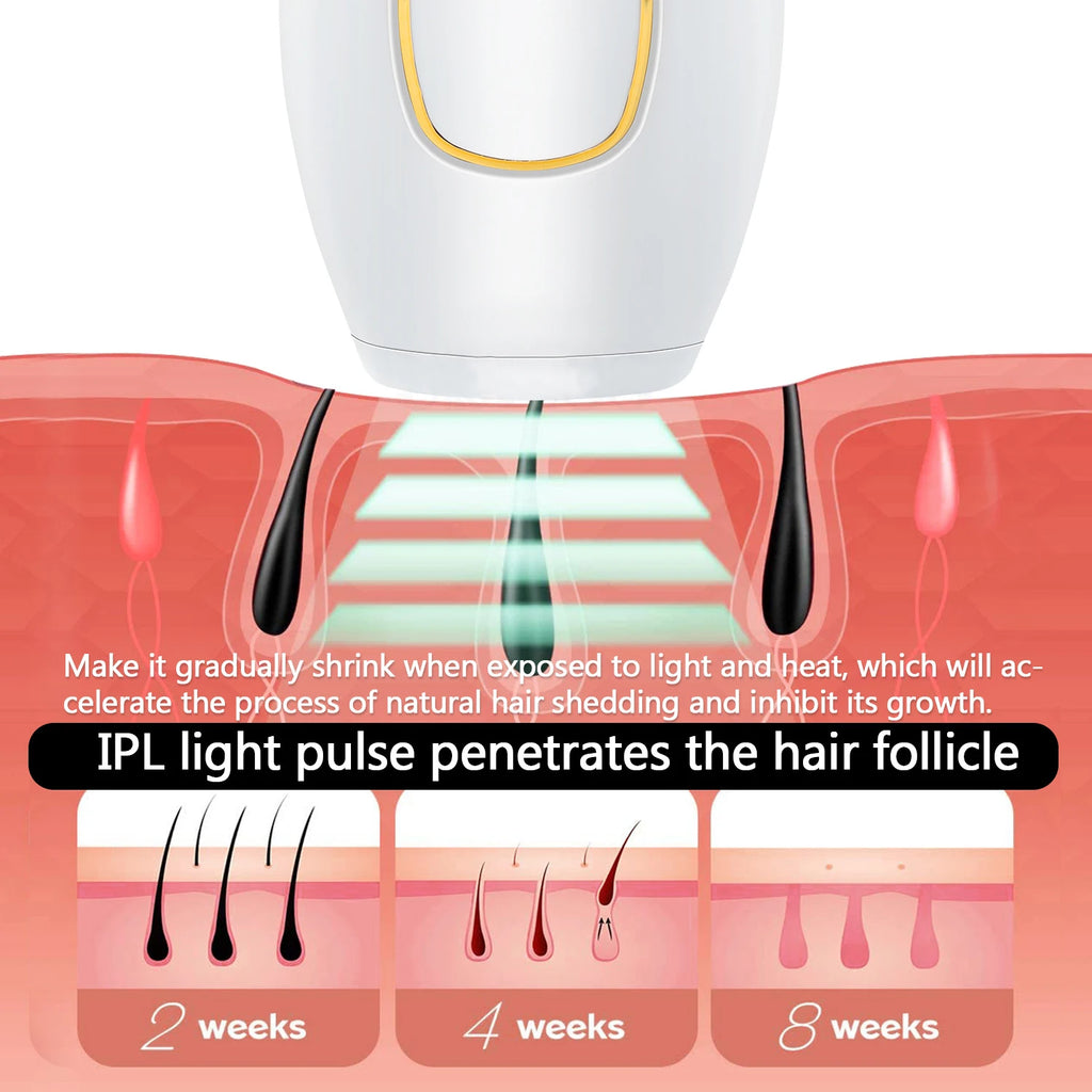 Depiladora láser IPL Glow para mujer, dispositivo de depilación láser permanente para bikini y cuerpo, uso doméstico.