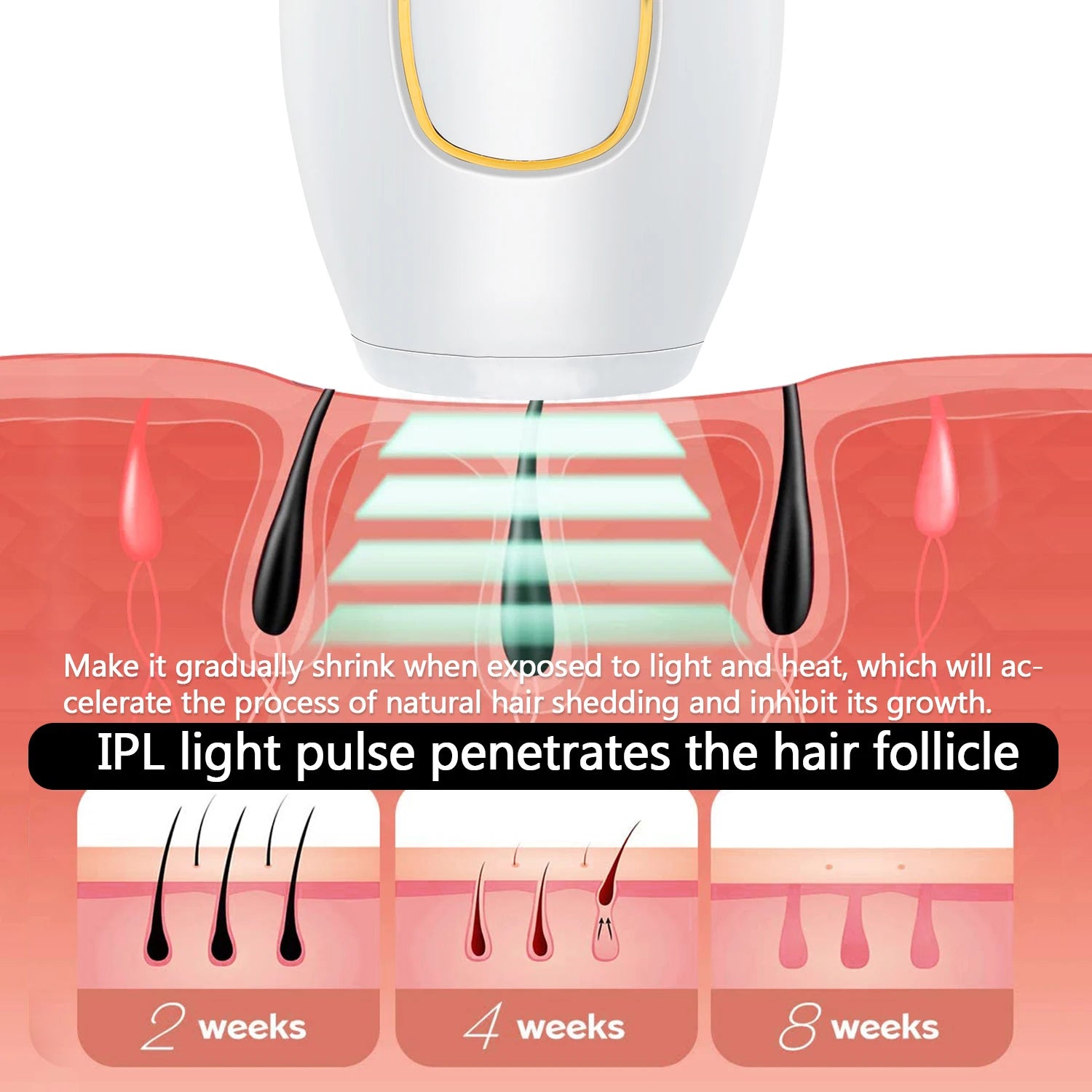 Depiladora láser IPL Glow para mujer, dispositivo de depilación láser permanente para bikini y cuerpo, uso doméstico.