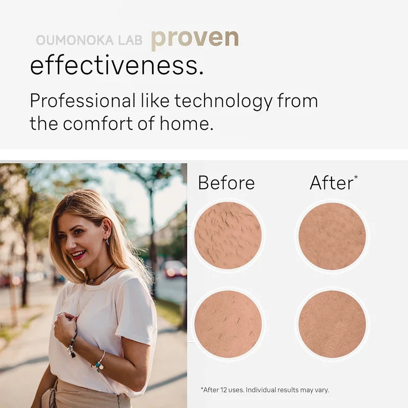 Depiladora láser IPL Glow para mujer y hombre, máquina para depilación facial y corporal, cortacésped y afeitadora facial.